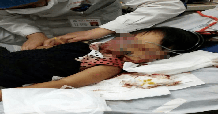 荣成车祸进ICU小孩不幸去世关于荣成车祸进ICU小孩不幸去世这一事件，我感到非常遗憾和悲痛。这样的悲剧总是让人心情沉重，让人对生命的安全和保障产生更深刻的思考。